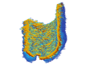 An image of the inside of a coronary artery obtained by CCTA.