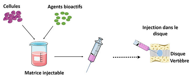 Thérapie injectable