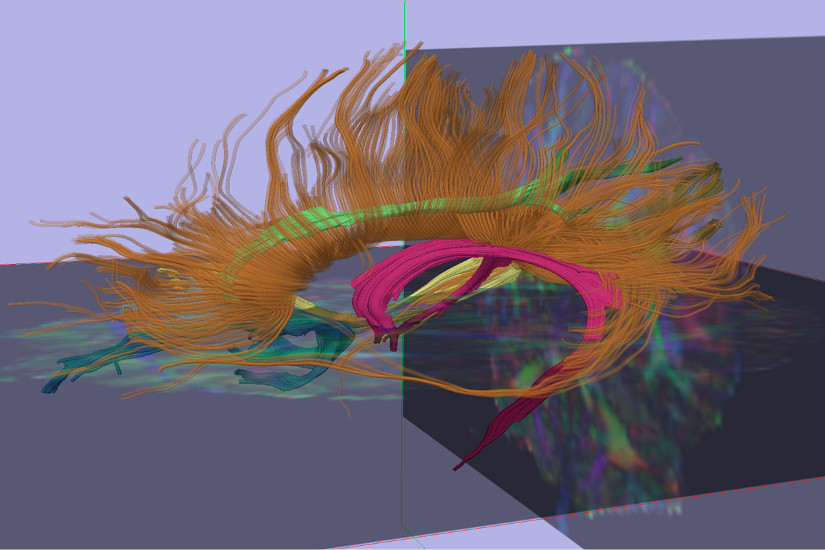 Dynamic visualization of complex data, illustrating flows and structures in 3D with bright and expressive colors.