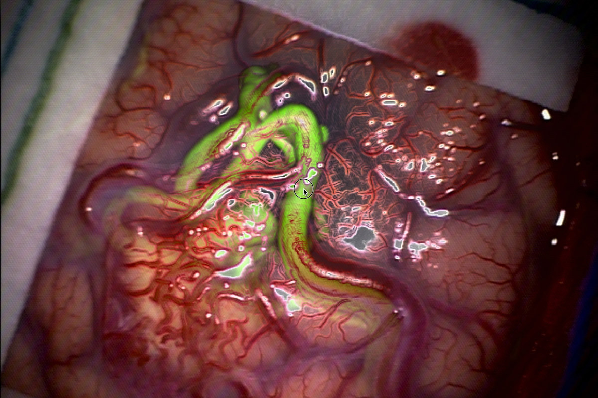 Detailed visualization of anatomical structures, highlighting blood vessels and surrounding tissues.