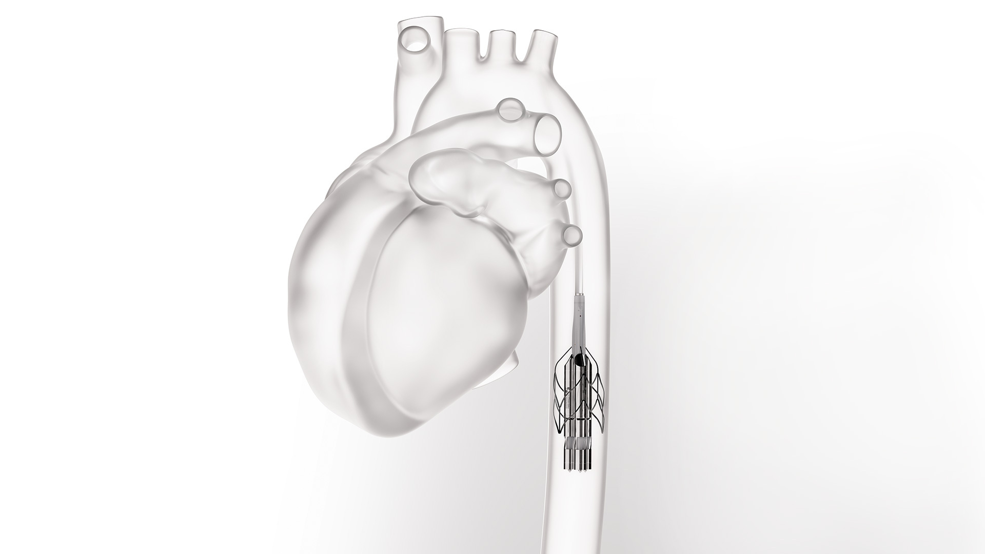 Innovation en bio-ingénierie : valve cardiaque et stent aortique.