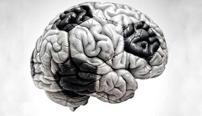 Cerveau humain symbolisant l'intelligence et l'innovation en technologie.
