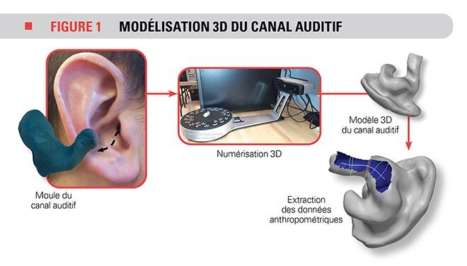 Modélisation 3D du canal auditif
