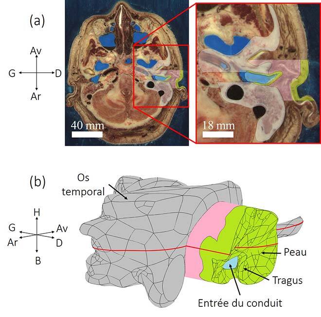 Modèle numérique construit à partir d’images anatomiques