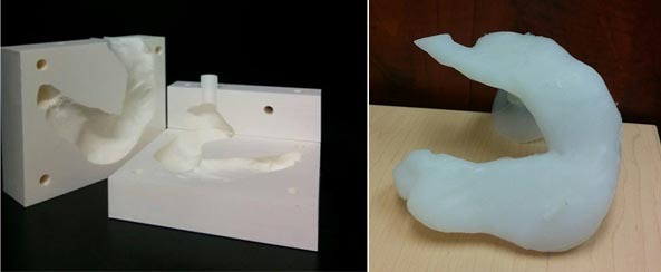 The 3D-printed stomach can be used to explain the gastic sleeve surgery (bariatric surgery)