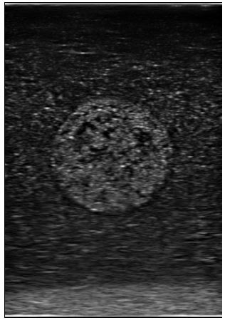 images obtenues par ultrasons