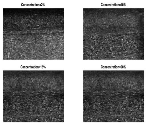 Ultrasound texture vs gelatin concentration in phantoms