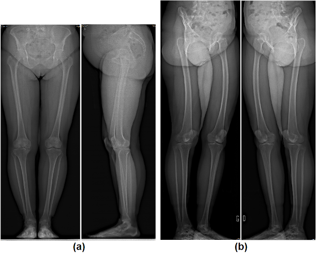 Radiographies des jambes selon différentes orientation