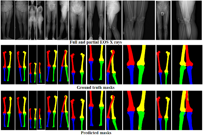 Bone identification using deep learning