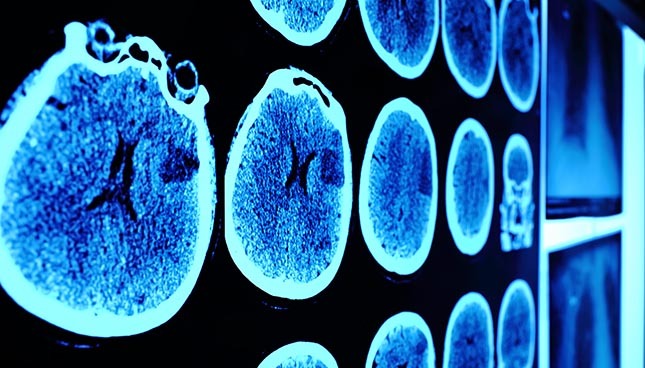 Advanced medical imaging technology displayed, showcasing brain scans.