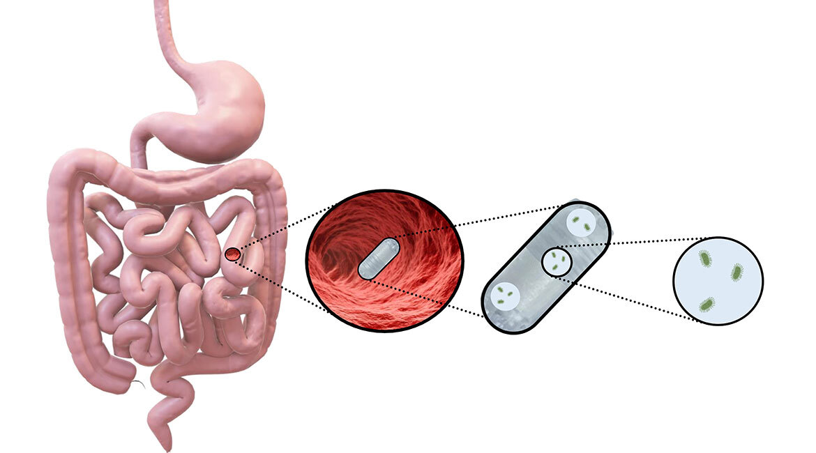 Schéma d'une pilule électronique dans le système digestif avec libération contrôlée de médicaments.