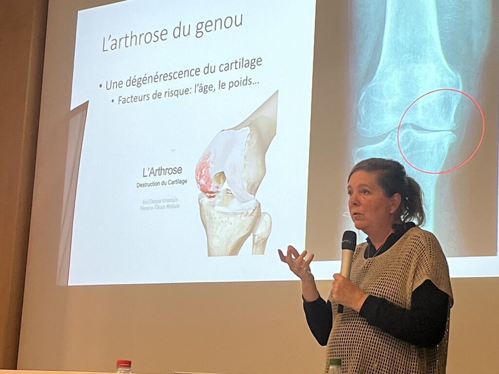 Conférence sur l'arthrose du genou, évoquant la dégradation du cartilage et les facteurs de risque tels que l’âge et le poids.