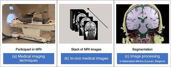 Head model developed using MRI images