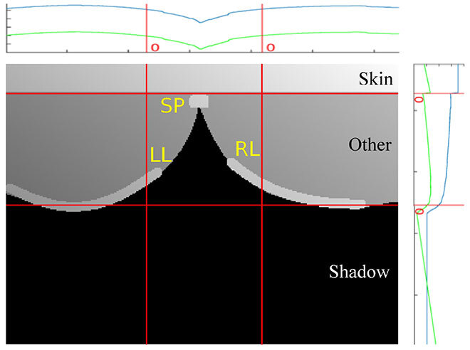 Proposed method to locate vertebrae