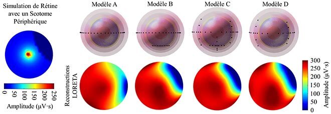 Simulation d’activité rétinienne