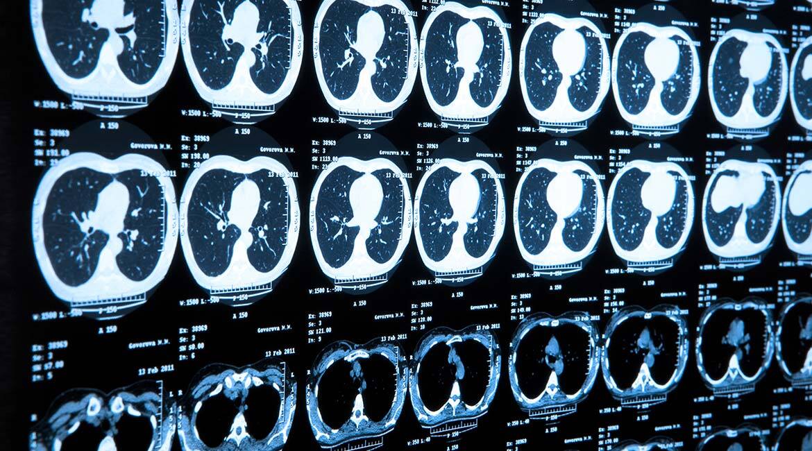 Scans IRM de cerveau en série, diagnostic médical avancé.