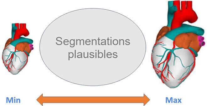 Dimension min et max d’un cœur